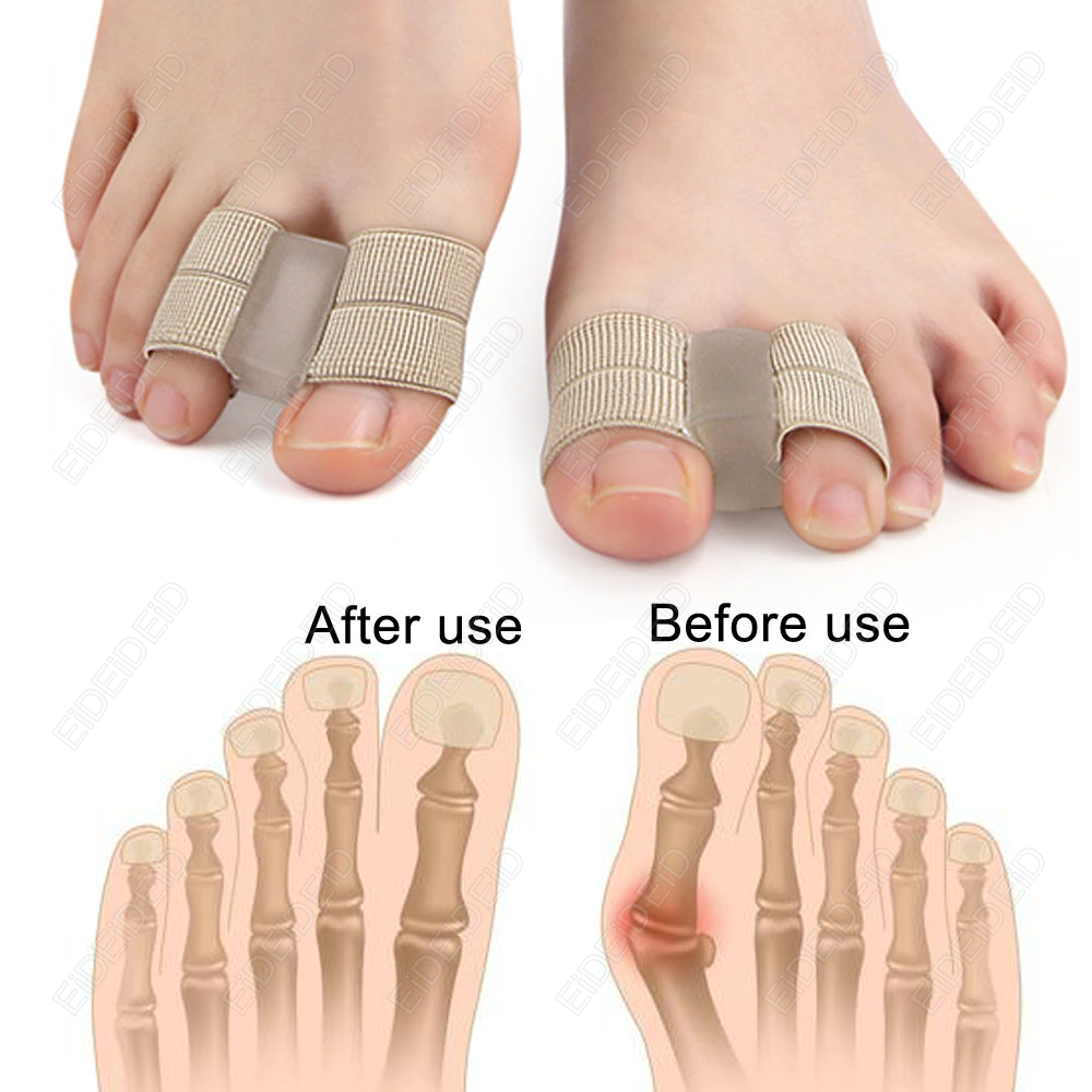 Корректор бурсита стопы, ортоп – обзор и цена Women'S Shoes For Bunions